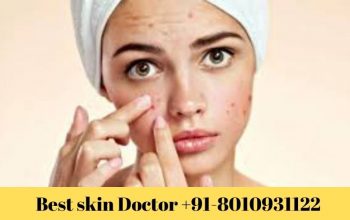 Best skin doctor Indraprastha 8010931122