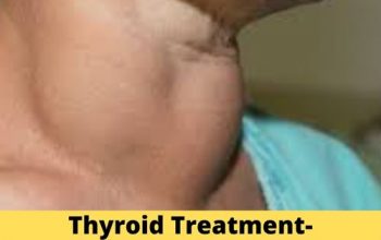 Best Thyroid doctor in Adrash nagar – 8010931122