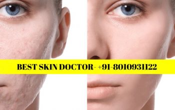 Best skin doctor Akshardham 8010931122